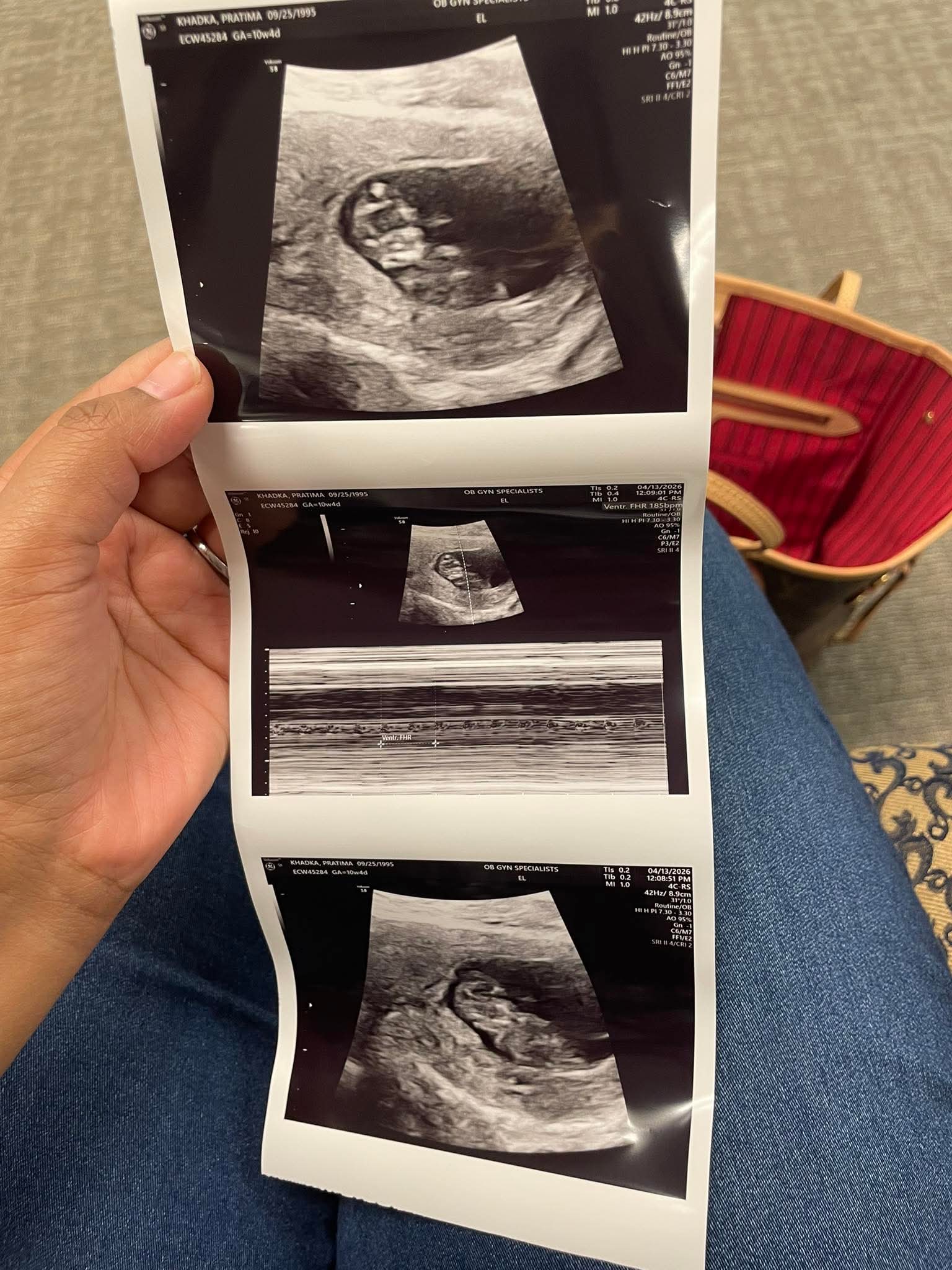 Third Scan